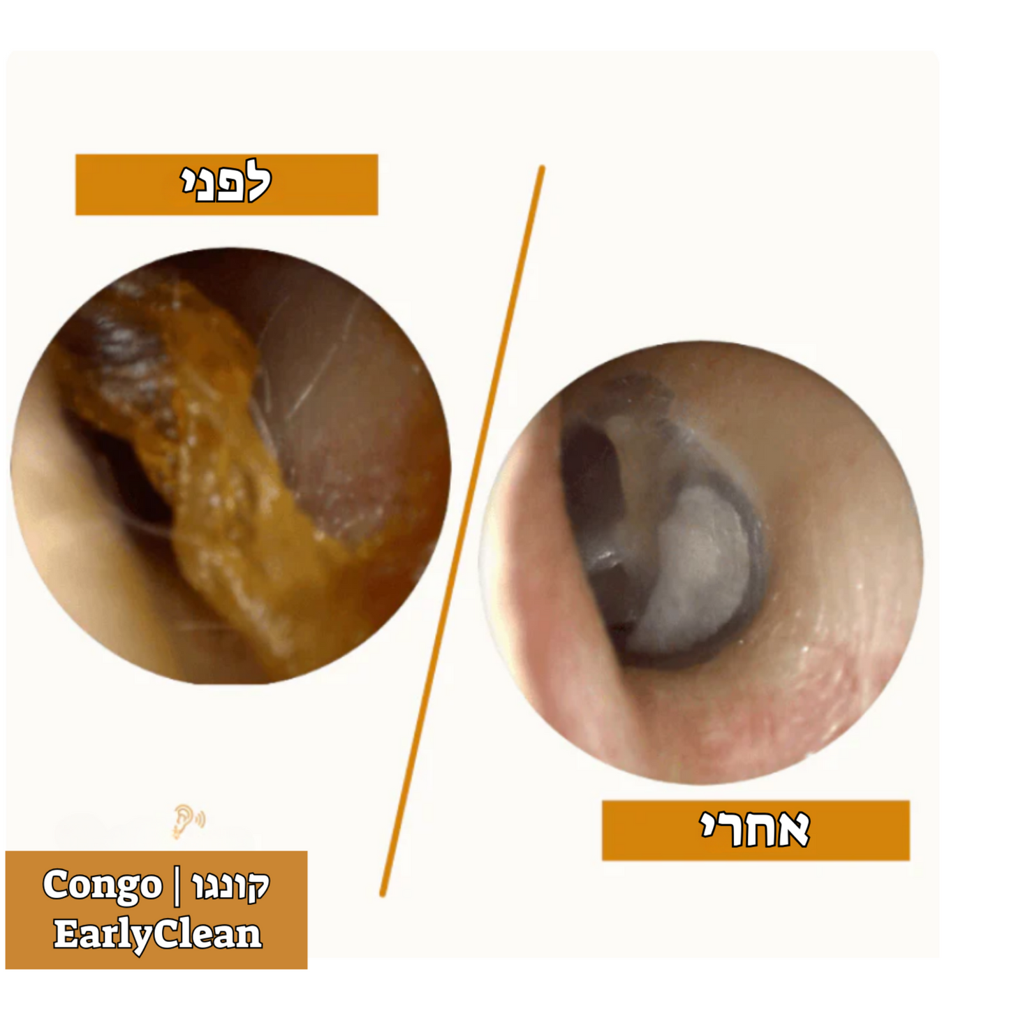 ™EarlyClean - מנקה שעווה מתקדם